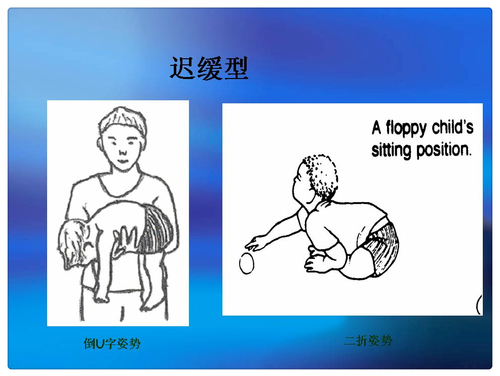 幻灯片8_mh1452675716875